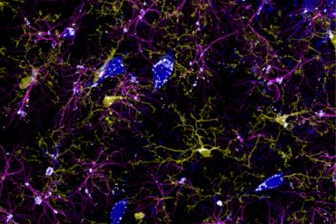 Riproduzione riservata difese immunitarie del cervello