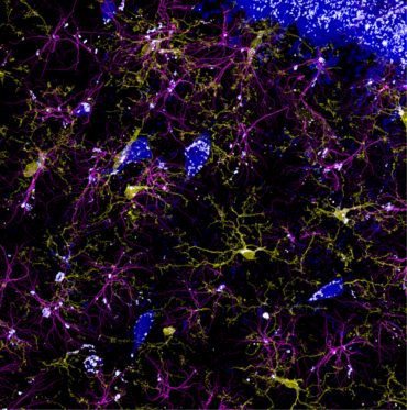 Riproduzione riservata difese immunitarie del cervello