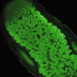 Immagini al microscopio confocale di una sezione del nodulo radicale: all’interno i batteri