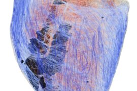 Ricostruzione digitale ad alta risoluzione della struttura cardiaca (la parte nera raffigura la fibrosi)