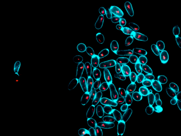Immagine al microscopio a fluorescenza di lieviti di Saccharomyces cerevisiae dello yaghnob cresciuti su galattosio (test del funzionamento mitocondriale)